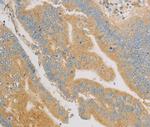 KLF17 Antibody in Immunohistochemistry (Paraffin) (IHC (P))