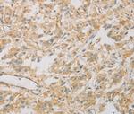 KLF17 Polyclonal Antibody