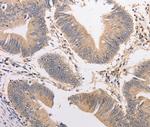 PIP5K1A Polyclonal Antibody