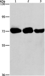 PIP5K1A Antibody in Western Blot (WB)