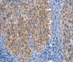UCK1 Polyclonal Antibody