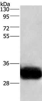 GPM6A Antibody in Western Blot (WB)