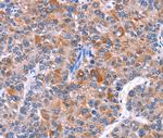 ELP2 Antibody in Immunohistochemistry (Paraffin) (IHC (P))