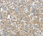 ASCC1 Polyclonal Antibody