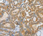 ASCC1 Antibody in Immunohistochemistry (Paraffin) (IHC (P))
