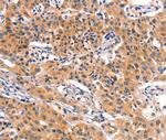 Pancreatic Amylase Polyclonal Antibody