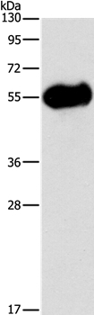 Pancreatic Amylase Antibody in Western Blot (WB)