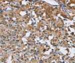 ANKHD1 Antibody in Immunohistochemistry (Paraffin) (IHC (P))