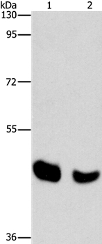 BAAT Antibody in Western Blot (WB)