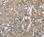 CAB39L Polyclonal Antibody