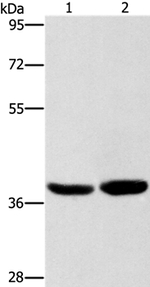 CAB39L Antibody in Western Blot (WB)