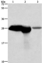 Calbindin D28K Antibody in Western Blot (WB)