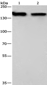 NCAPD2 Antibody in Western Blot (WB)