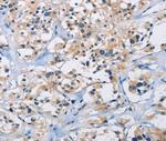 CARD14 Polyclonal Antibody