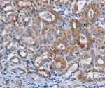 CASC3 Polyclonal Antibody