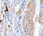 CATSPER1 Polyclonal Antibody