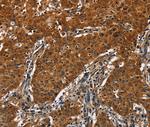 CATSPER4 Polyclonal Antibody