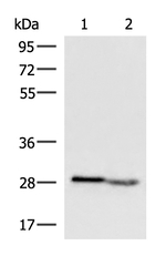 KLRB1 Antibody in Western Blot (WB)