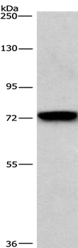 BCAM Antibody in Western Blot (WB)
