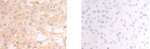 CHDH Polyclonal Antibody