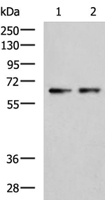 CHDH Antibody in Western Blot (WB)