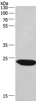 CHMP1A Antibody in Western Blot (WB)