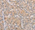CHMP4B Antibody in Immunohistochemistry (Paraffin) (IHC (P))