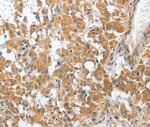 CHMP4B Polyclonal Antibody