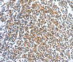 CKAP2 Antibody in Immunohistochemistry (Paraffin) (IHC (P))