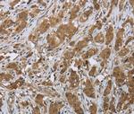 CLPS Antibody in Immunohistochemistry (Paraffin) (IHC (P))