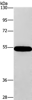 CNDP1 Antibody in Western Blot (WB)