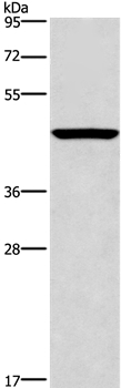 Carboxypeptidase A2 Antibody in Western Blot (WB)