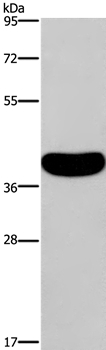 CRELD2 Antibody in Western Blot (WB)