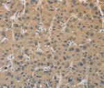 CYFIP2 Polyclonal Antibody