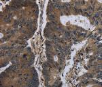 BRINP1 Antibody in Immunohistochemistry (Paraffin) (IHC (P))