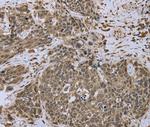 Dynactin 4 Polyclonal Antibody