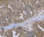 Dynactin 4 Antibody in Immunohistochemistry (Paraffin) (IHC (P))