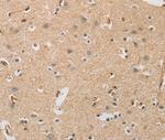 DCTN5 Antibody in Immunohistochemistry (Paraffin) (IHC (P))