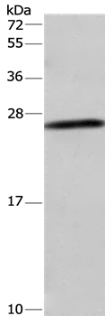 DCTN6 Antibody in Western Blot (WB)