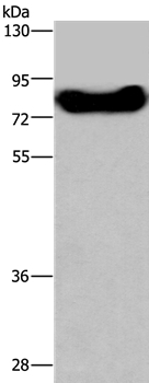 DDX43 Antibody in Western Blot (WB)