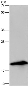 RNASE3 Antibody in Western Blot (WB)