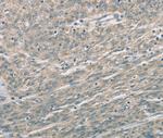 EDA2R Polyclonal Antibody