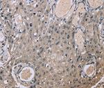 EID1 Polyclonal Antibody
