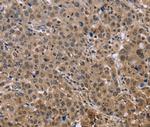 KIF25 Antibody in Immunohistochemistry (Paraffin) (IHC (P))