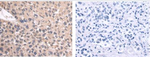 UCC1 Polyclonal Antibody