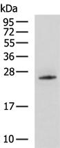 UCC1 Antibody in Western Blot (WB)