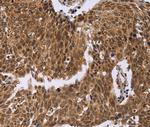 ERCC6L Polyclonal Antibody