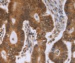 ERCC6L Antibody in Immunohistochemistry (Paraffin) (IHC (P))