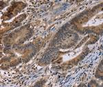 FAM107A Antibody in Immunohistochemistry (Paraffin) (IHC (P))