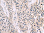 FAR2 Polyclonal Antibody